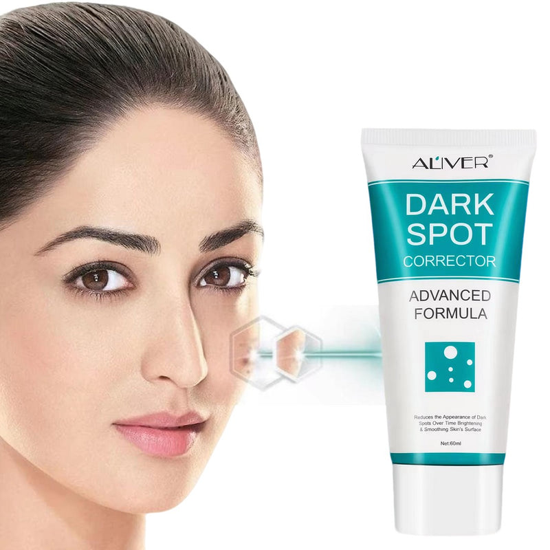 Dark spot crema aclaradora