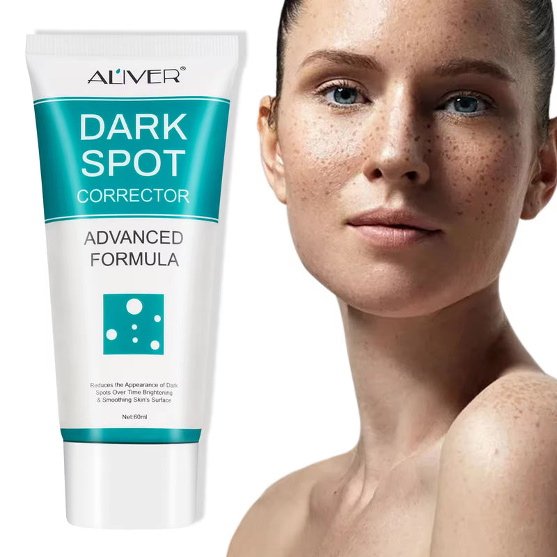 Dark spot crema aclaradora