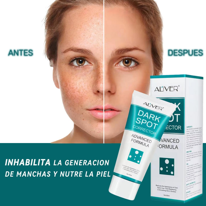 Dark spot crema aclaradora