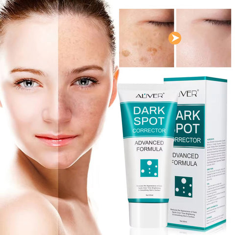 Dark spot crema aclaradora