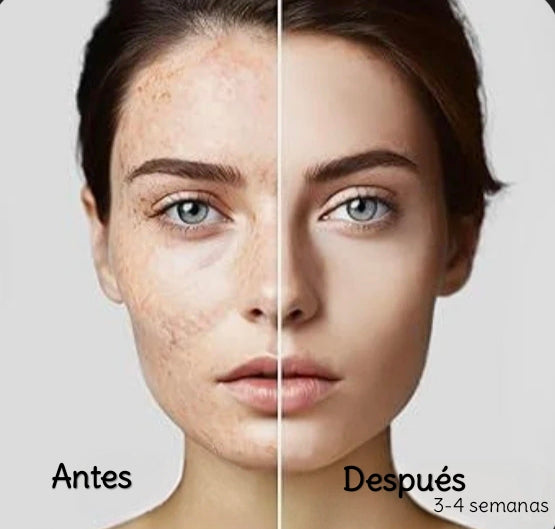 Dark spot crema aclaradora