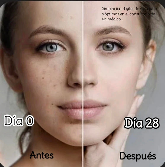 Dark spot crema aclaradora
