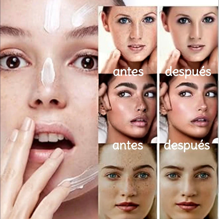 Dark spot crema aclaradora