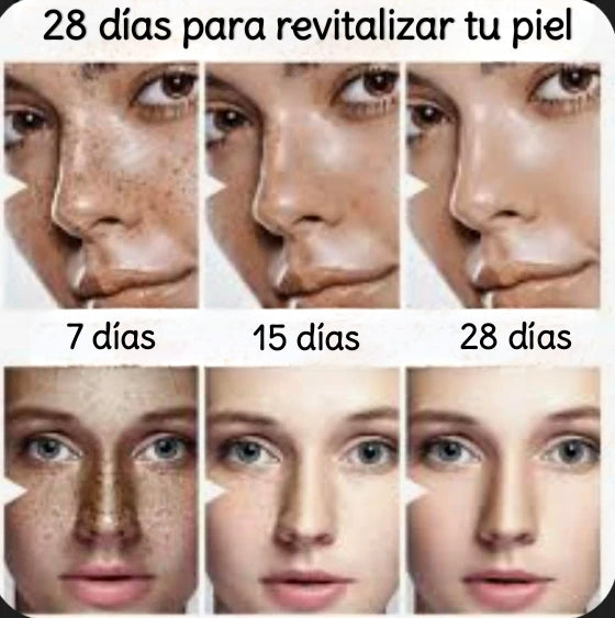 Dark spot crema aclaradora
