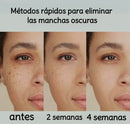 Dark spot crema aclaradora