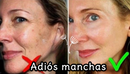 Dark spot crema aclaradora