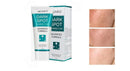 Dark spot crema aclaradora