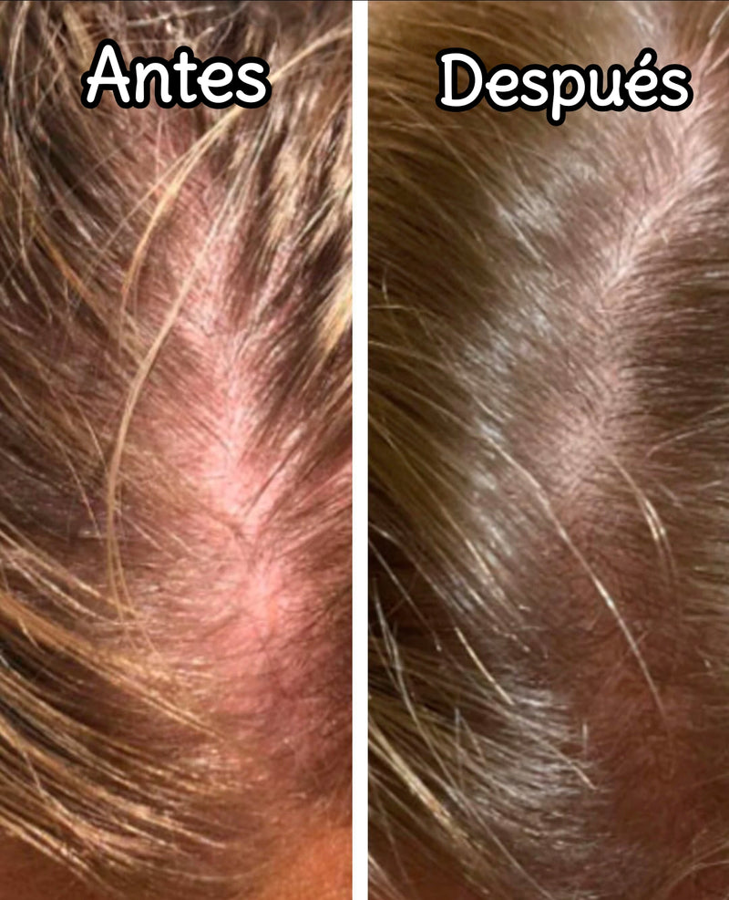 spray crecimiento por ouhoe CJ X2