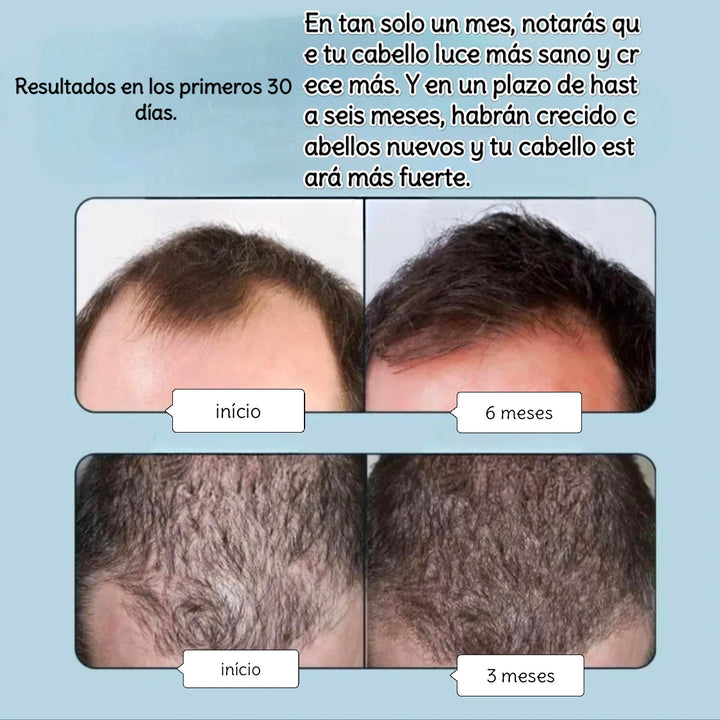 Spray crecimiento por ouhoe CJ X2