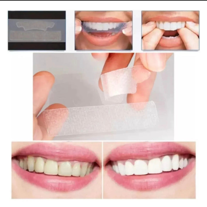 Tira Blanqueadora Dental x 7 Pares x2