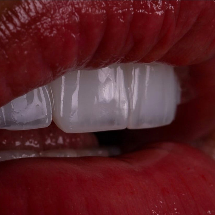 Tira Blanqueadora Dental x 7 Pares x2