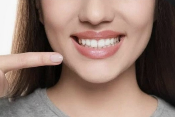 Tira Blanqueadora Dental x 7 Pares x2