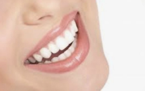 Tira Blanqueadora Dental x 7 Pares x2