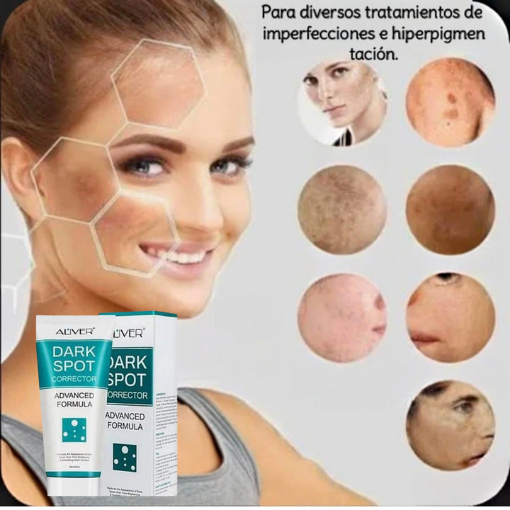 Dark spot crema aclaradora