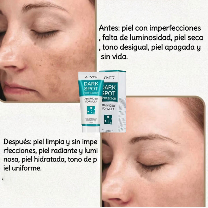 Dark spot crema aclaradora