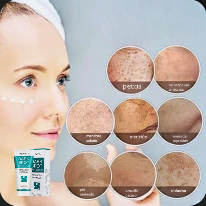 Dark spot crema aclaradora