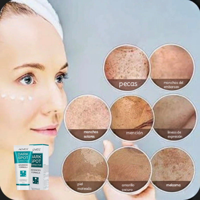 Dark spot crema aclaradora