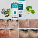 Dark spot crema aclaradora