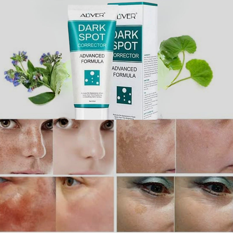 Dark spot crema aclaradora