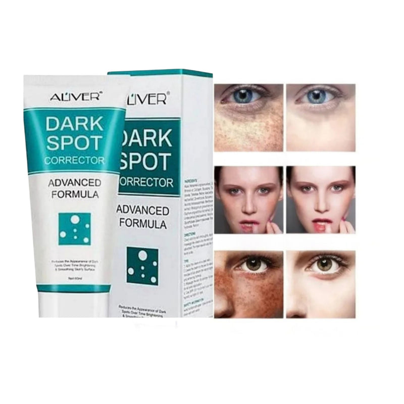 Dark spot crema aclaradora