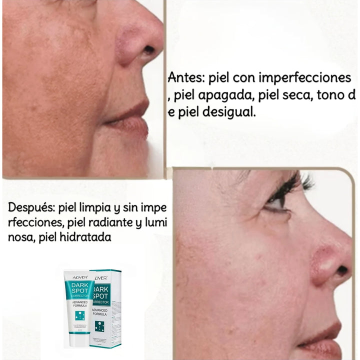 Dark spot crema aclaradora
