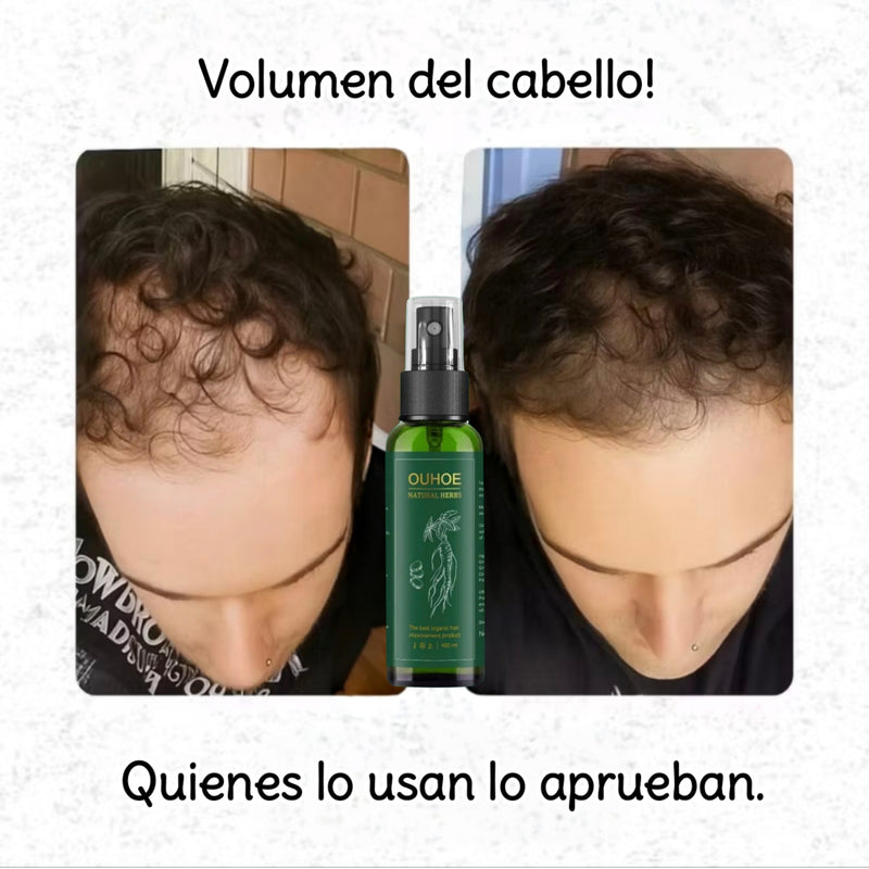 spray crecimiento por ouhoe CJ X2